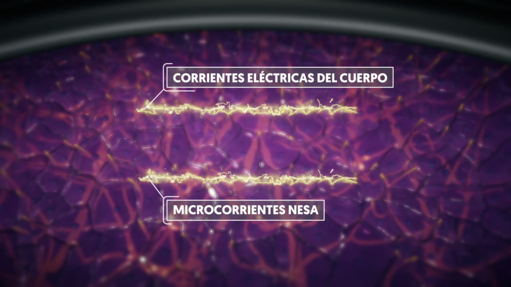 neuromoduación no invasiva