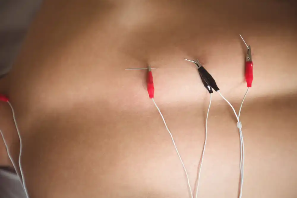 clinica-especializada-fisioterapia-invasiva