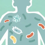 Intestino delgado con sobrecrecimiento bacteriano SIBO explicado